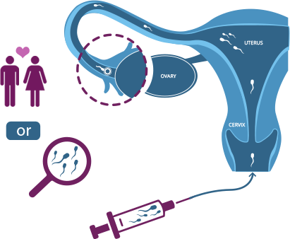 YOUR CHANCES WITH Ovulation Induction