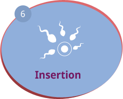 Insertion